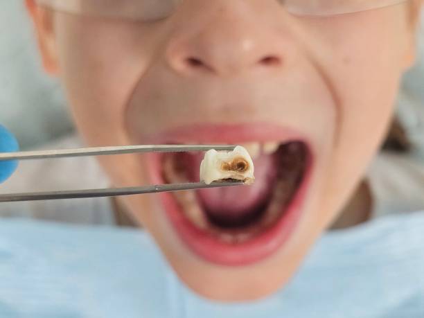 Best Emergency Dental Clinic in VT