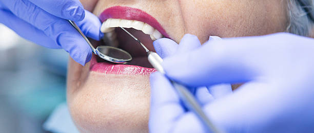 Best Dentist for Tooth Abscess  in St Albans, VT